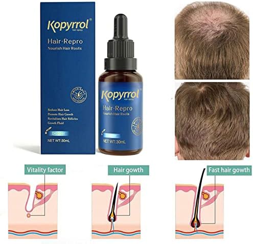 30 мл есенции за лечение на косопад при мъжете, жените, предотвратява загубата на коса, серум за растеж на косата, възстановява